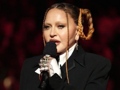 Madonna releases a new photo of her face and claims that the swelling from surgery has subsided.